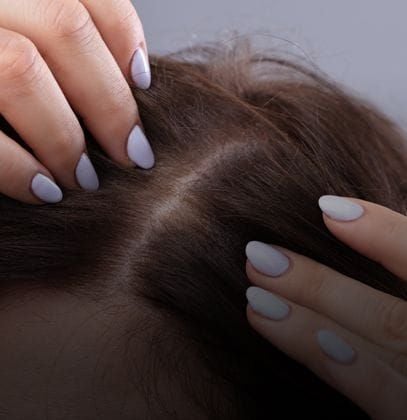 Exploring Treatment for Hair loss: Solutions for Thicker, Healthier Hair Exploring Treatment for Hair loss: Solutions for Thicker, Healthier Hair